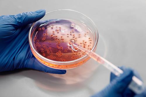Is Kuros Biosciences' MagnetOs™ Poised for Explosive Growth