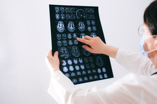 Neurodegenerative R&D's Harsh Reality: Alector's Collapse vs. Ionis's Resilience Amid Partner Exits