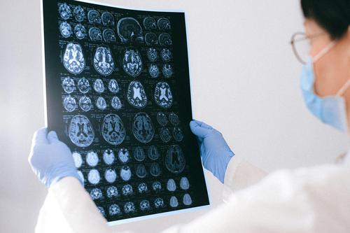 Is Biogen (BIIB) a Buy, Hold, or Sell Right Now