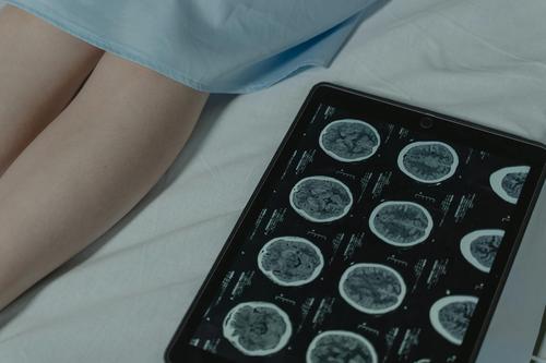 Is Protagenic Therapeutics (PTIX) Poised for a Breakthrough in Neuropsychiatric Treatment