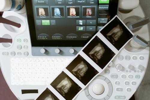 Is VisionPro Imaging's AI a Game-Changer for Radiology