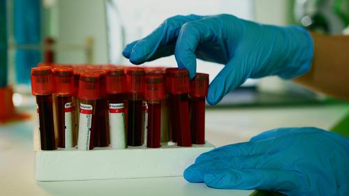 Is Arcturus Therapeutics' ARCT-032 a Game Changer for Cystic Fibrosis