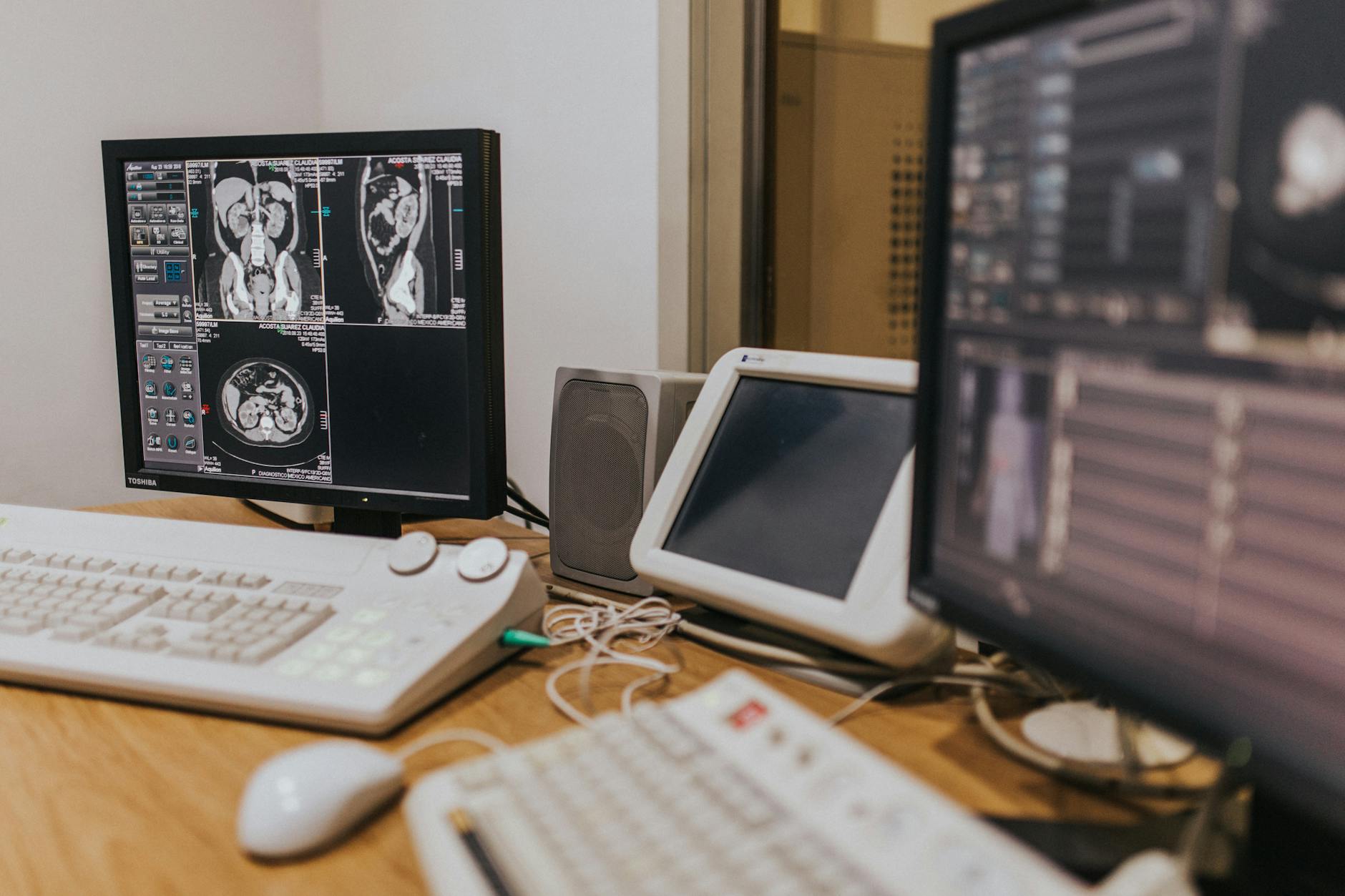 Is Precision Optics (POCI) Poised for a Breakthrough in Medical Imaging