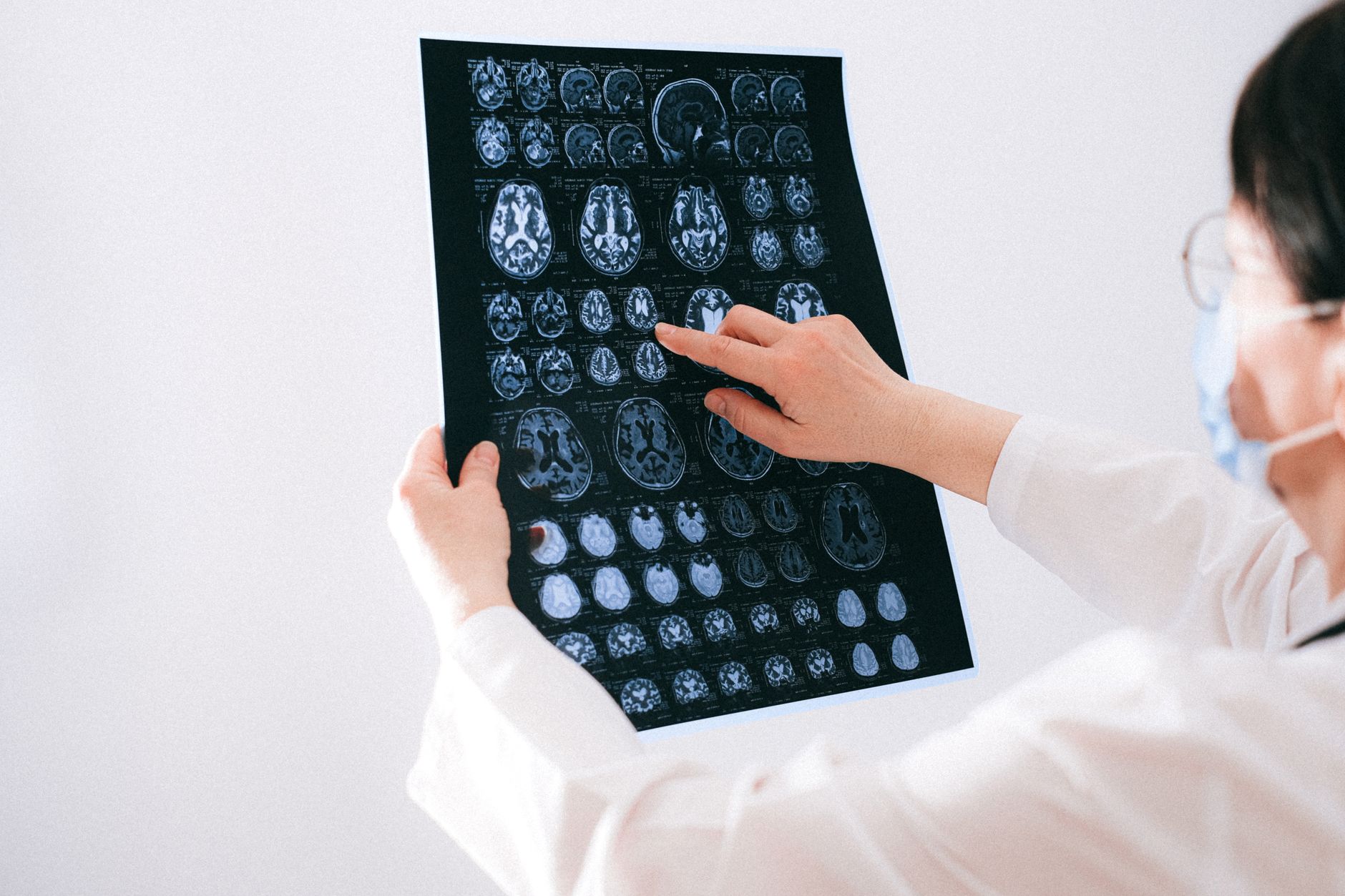 Neurodegenerative R&D's Harsh Reality: Alector's Collapse vs. Ionis's Resilience Amid Partner Exits
