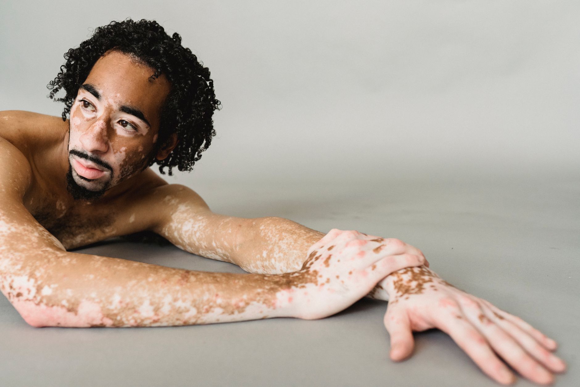 Forte Biosciences' Vitiligo Triumph: A High-Stakes Bet on Broad Autoimmune Potential