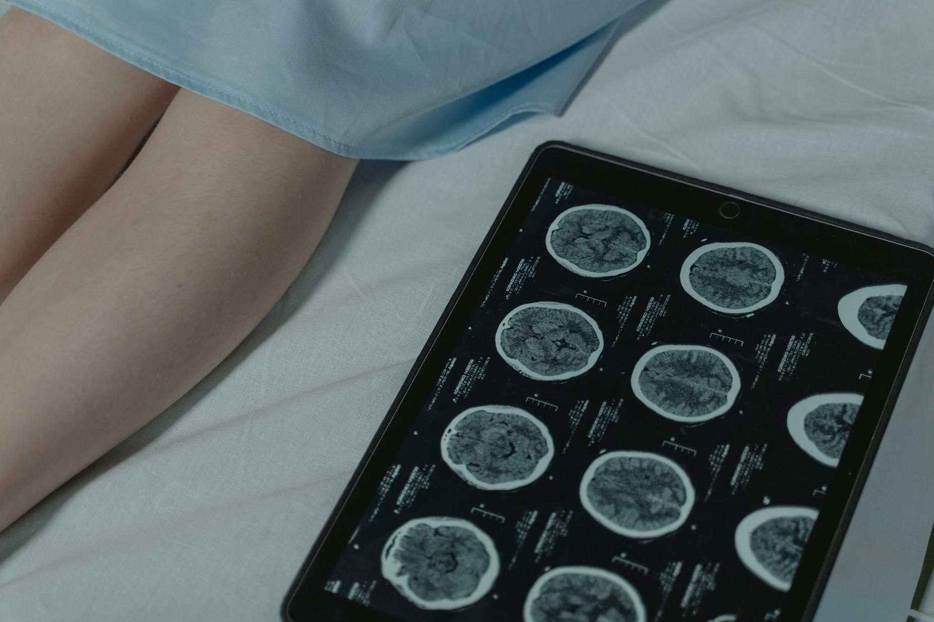 Is Protagenic Therapeutics (PTIX) Poised for a Breakthrough in Neuropsychiatric Treatment