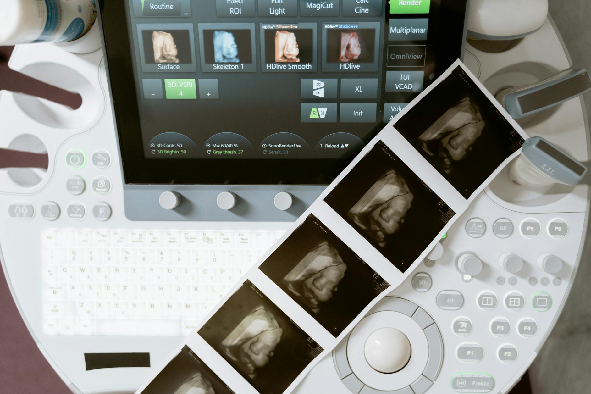 Is VisionPro Imaging's AI a Game-Changer for Radiology